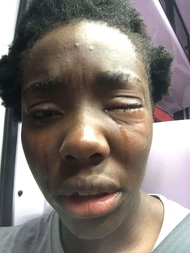 Uova in faccia – Aggressione razzista contro l’atleta Daisy Osakue: “Un fatto orrribile”