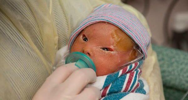 Ondata di solidarietà per il bimbo abbandonato a Torino perché malato – Aperto il conto corrente, numerose le donazioni