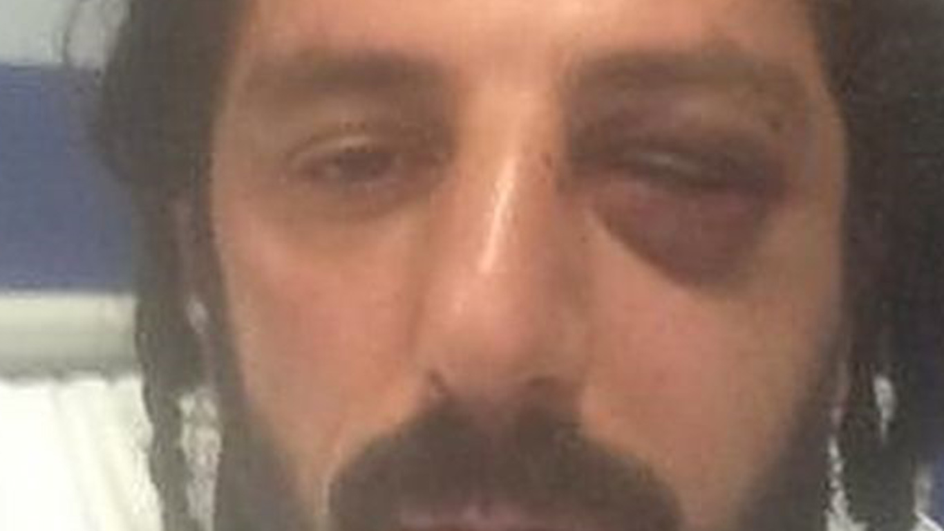 Torino, pestato a sangue all’uscita da un Centro Sociale “Un attacco squadrista”