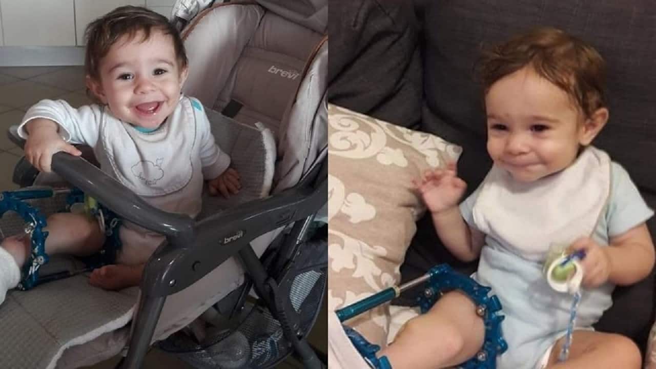 Aiutiamo Kevin, il bimbo di 2 anni nato a Torino con una patologia rarissima – La storia commuove il web