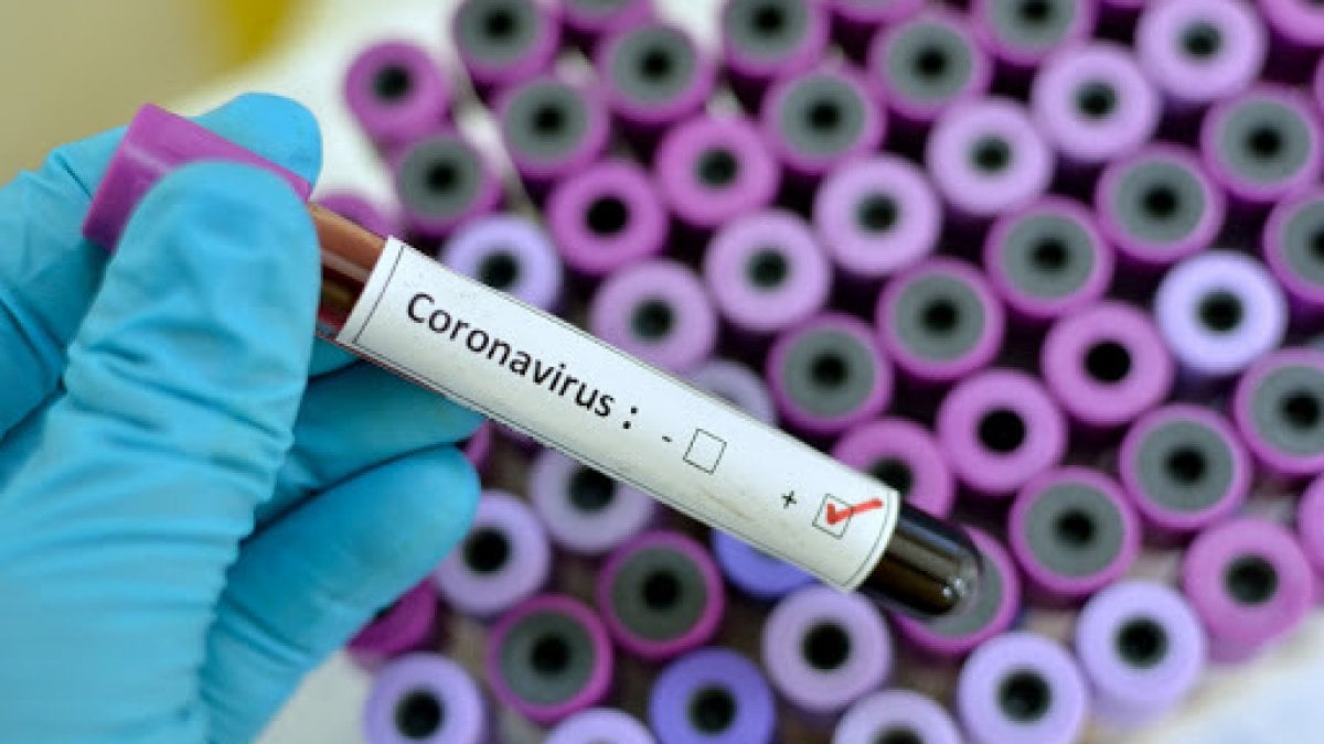 Coronavirus – A Torino parte la sperimentazione di un nuovo farmaco anti-Covid 19