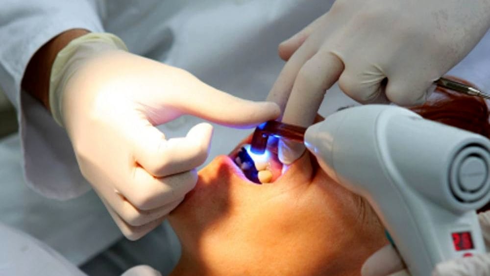 Torino, padre e figlio erano dentisti abusivi – Studio sotto sequestro