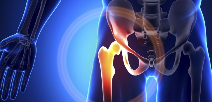 Protesi d’anca – Arrivano interventi personalizzati  “al millimetro” grazie al navigatore computerizzato. Ecco la nuova tecnologia
