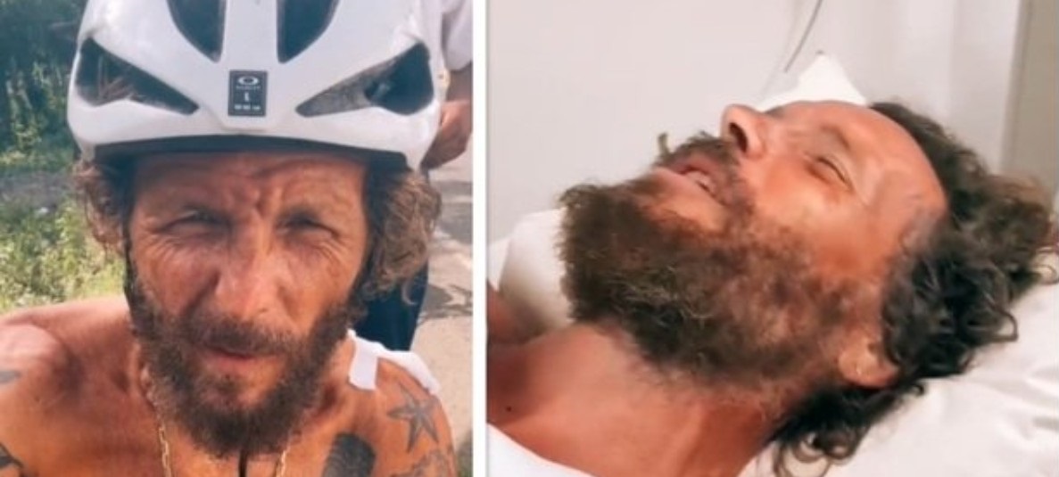 Jovanotti ‘vola’ dalla bicicletta. Disastroso incidente “Rotti clavicola e femore”