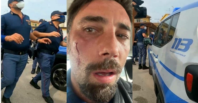 Torino – Brumotti di Striscia ancora aggredito in città. Assalito dai pusher con sassi e bottiglie a Torino