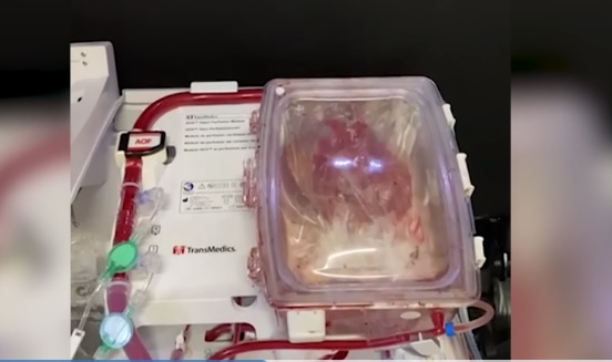 Torino – Miracolo alle Molinette: il cuore batte anche fuori dal petto. Salvato un paziente