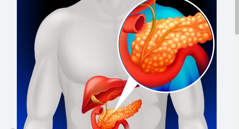 Arriva il pancreas “artificiale” – Nuova era per il diabete