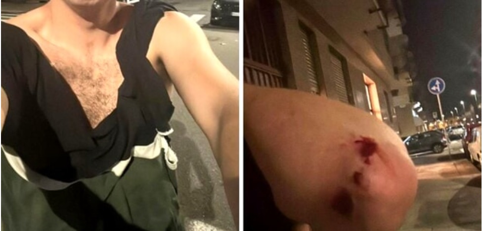 Torino – Aggressione giornalista, parla il Presidente Ordine Piemonte: “Clima inaccettabile”. Identificati due aggressori