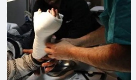 Torino – A 13 anni gli esplode in mano petardo ‘fatto in casa’. Cosa è successo