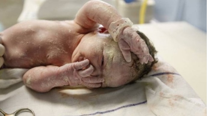 In Piemonte bimba nasce “con la camicia”. Evento estremamente raro: accade ogni 80mila parti